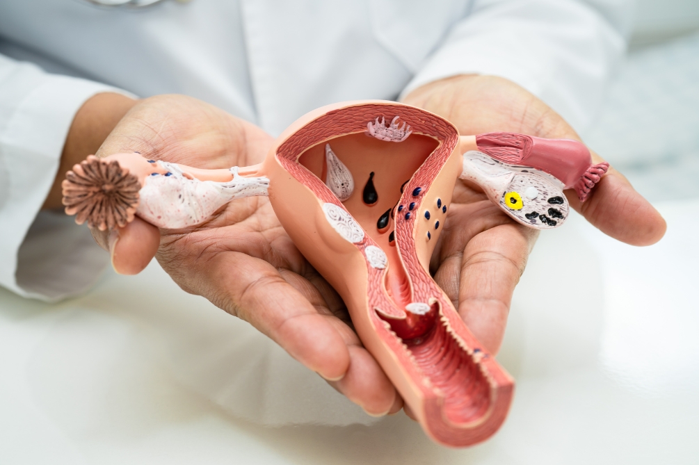 子宮頸がん（しきゅうけいがん）とは